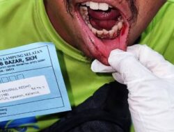 Ditarbrak dari Belakang, Seorang Wartawan di Lamsel Malah Dianiaya
