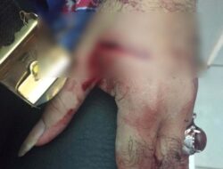 Adu Jotos Hingga Bersimbah Darah! Sekretaris Dinas Koperindag Tanggamus Dilarikan Ke Rumah Sakit