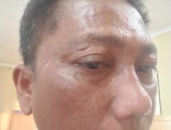 DPD PJS Sumut Desak Polisi Tangkap Pelaku Penganiayaan Wartawan di Toba